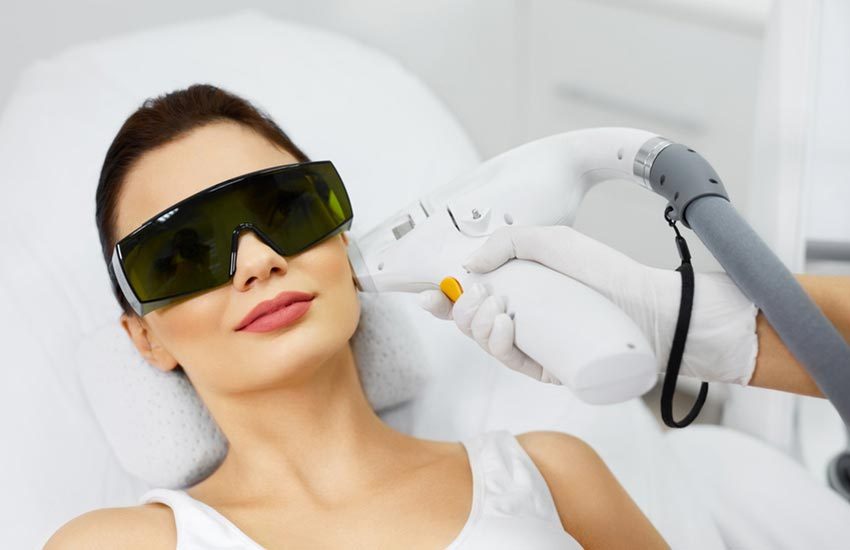 laser hair removal